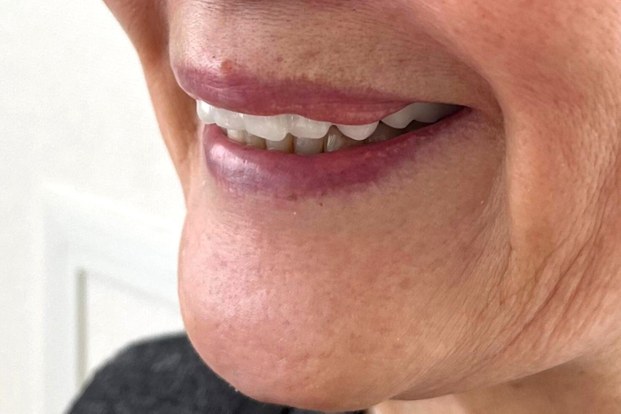 白一色の装着時