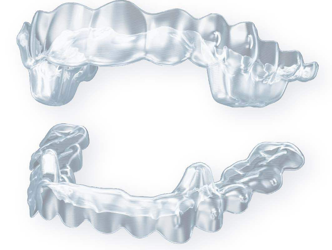 下顎前方誘導装置