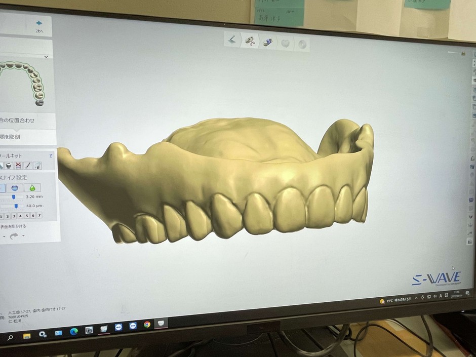 データが3Dに変換され保管