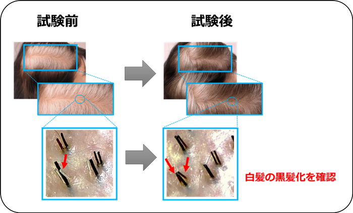図3：明確な白髪の改善を複数確認