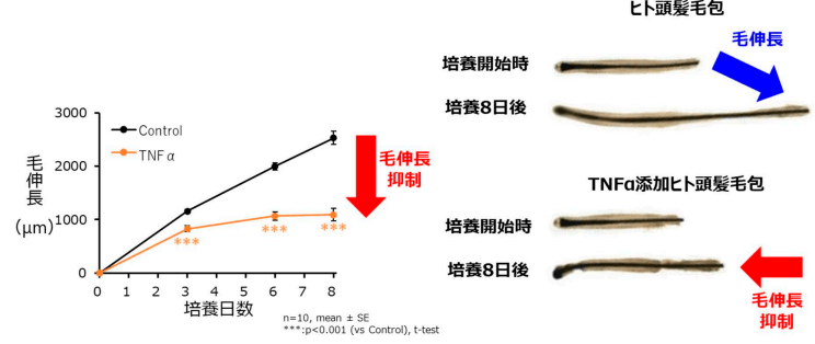 図2 ヒト頭髪毛包の毛伸長に対する炎症(TNFα※2)の影響