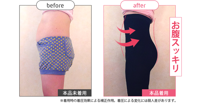 ストレグ横腹Before／After