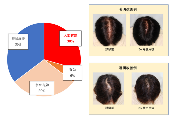 図3：週に1回の冷却刺激により65％のヒトに育毛効果を確認