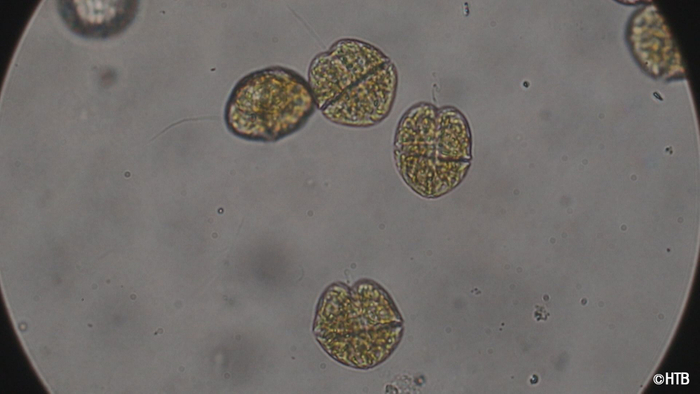 テレメンタリー「赤潮」赤潮を引き起こしたカレニア・セリフォルミス(C)HTB