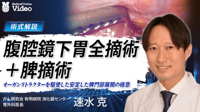 腹腔鏡下胃全摘術+脾摘術
