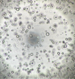 ヒト膵がん患者由来オルガノイドの増殖試験(8日後)　b) 既存ポリスチレン製プレート／地方独立行政法人大阪府立病院機構大阪国際がんセンター 平塚 徹 チームリーダー ご提供