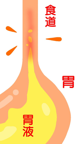 食道と胃のイラスト