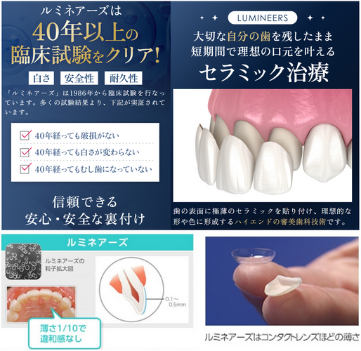歯を全く削らない・痛みのない「ルミネアーズ」審美歯科治療