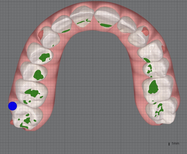 グリーンでマーキングされているところがかみ合わせが当たっているところ