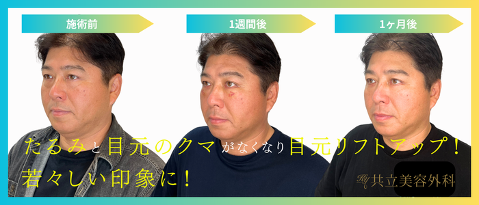 真中満氏クマ取り治療