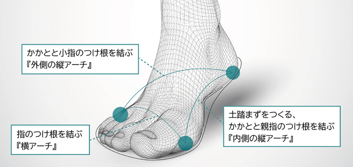 アーチサポート