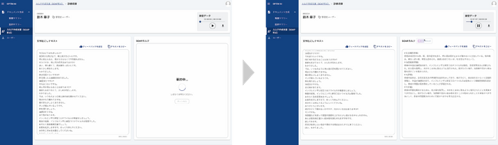 カルテの作成支援β版