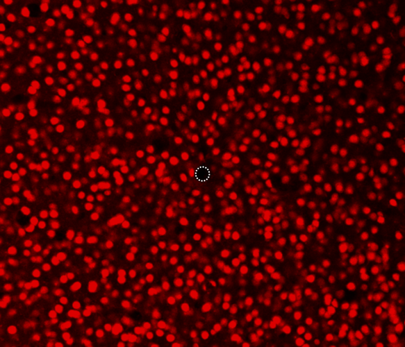 図：直径5 &micro;mマイクロニードル電極周辺の神経細胞（ニューロン）の観察