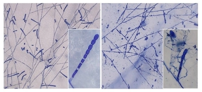 世界初！菌寄生菌による農薬耐性うどんこ病菌の感染拡大防止を確認　うどんこ病防除法の開発と農薬使用量の低減に期待