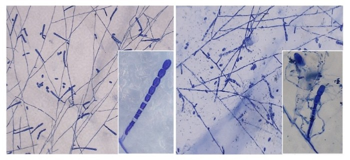 農薬を噴霧したメロンうどんこ病菌の菌糸（左）・農薬処理後に菌寄生菌の胞子を噴霧したメロンうどんこ病菌の菌糸（右）