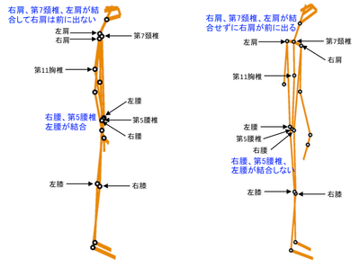 図1(Ⅰ型タイプの『Csc』画像 図2(Ⅱ型タイプの『Csc』画像)