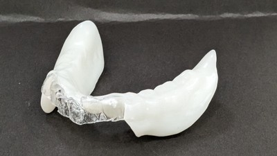部分入れ歯も製作可能