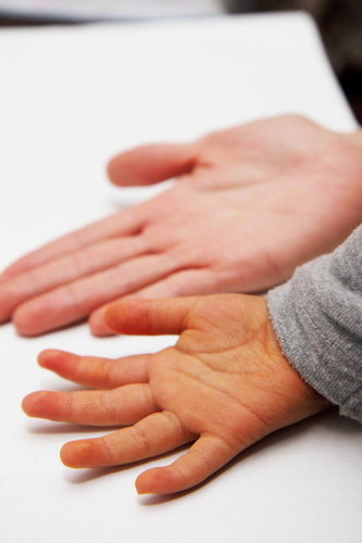 みかんを食べると手が黄色くなるのは&beta;-クリプトキサンチンの蓄積のため