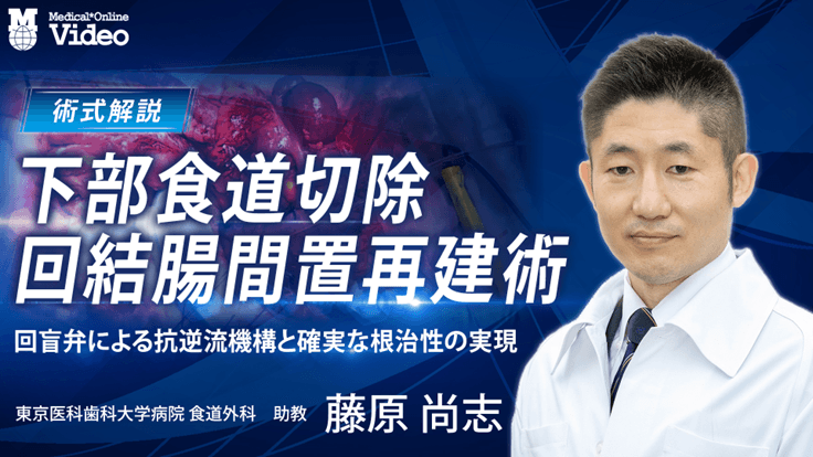 下部食道切除・回結腸間置再建術
