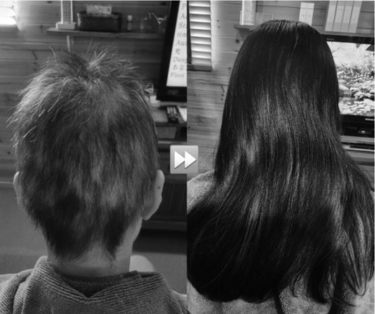 ４０代女性 ケア前&rarr;ケア後　※写真：福岡県 WOOD HEAL・垣田惠子様 提供