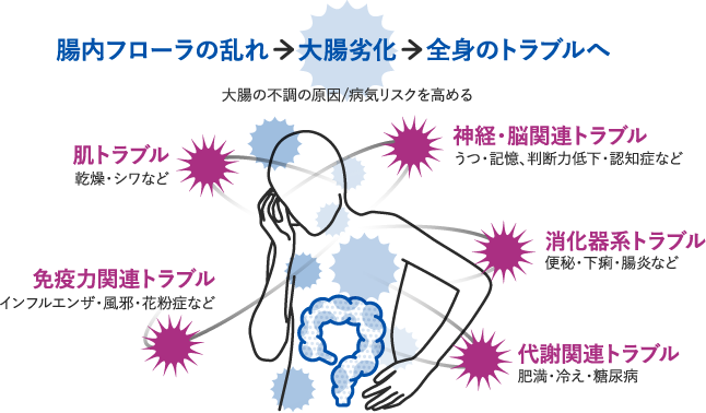 大腸劣化によるトラブルイメージ図