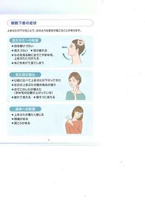 眼瞼下垂の症状