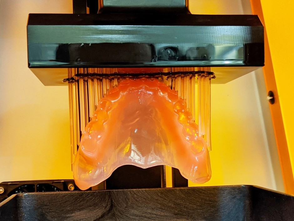 3Dプリンターで歯茎ができる様子