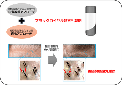 図1：2つのアプローチにより白髪を改善