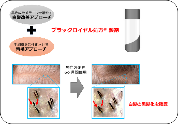 図1：2つのアプローチにより白髪を改善