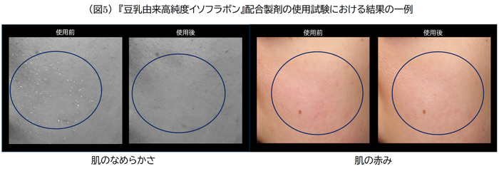 (図5)豆乳由来高純度イソフラボン配合製剤の使用試験における結果の一例