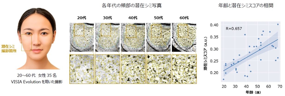 図1 加齢によるメラニンの蓄積と潜在シミスコアの上昇
