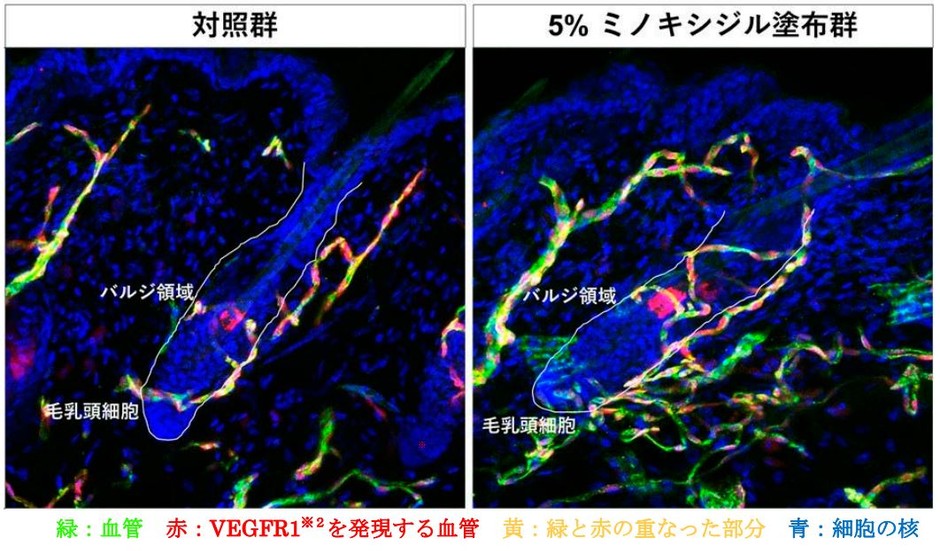 図１　ミノキシジル塗布による毛包周囲の血管の増加