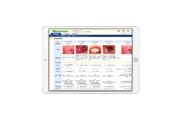 褥瘡経過管理画面