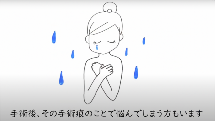 手術痕で悩む人も