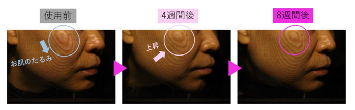 図6 F-ray解析によるたるみの変化の様子