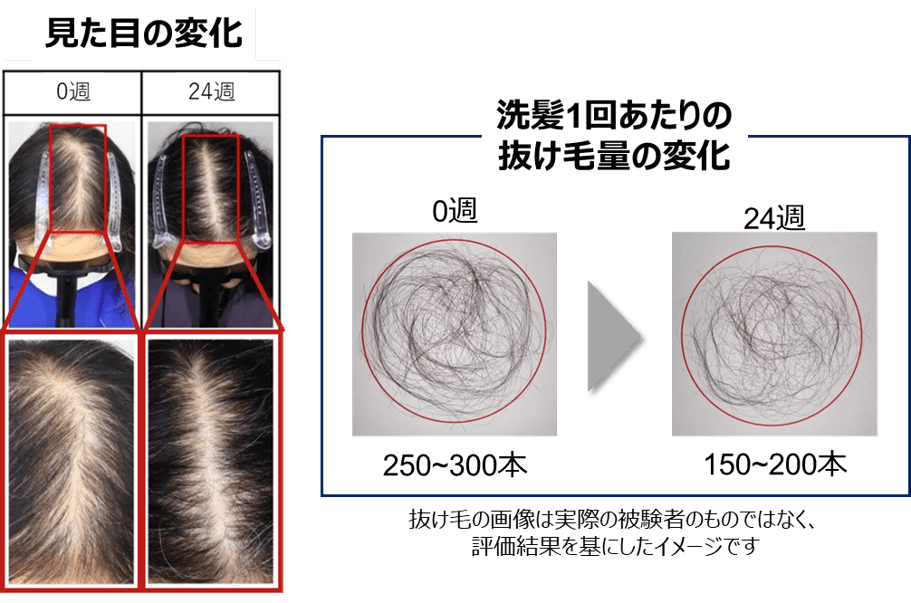 図4　著効例