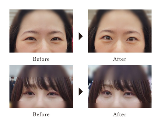 ※効果を保証するものではありません。