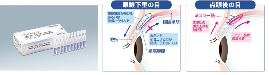 作用機序