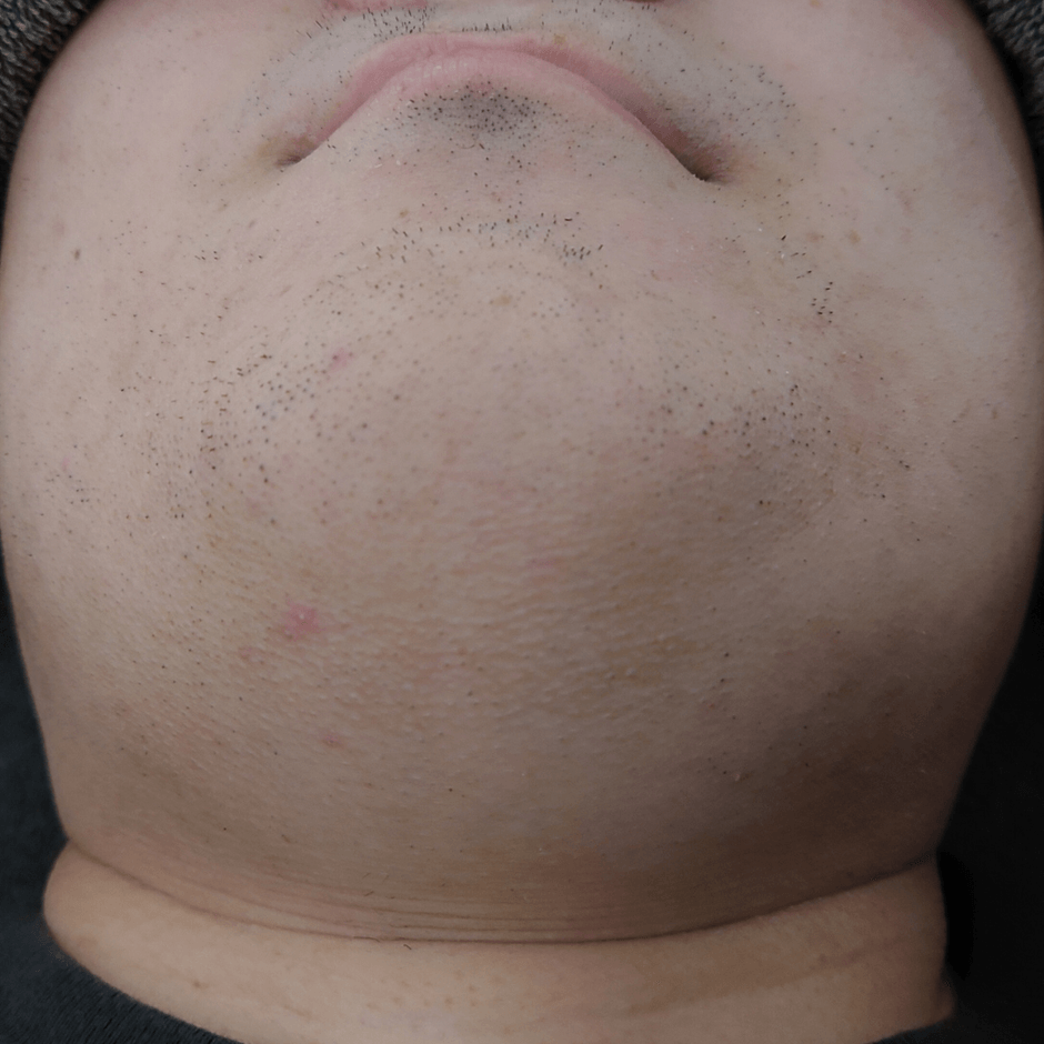 6回目の写真