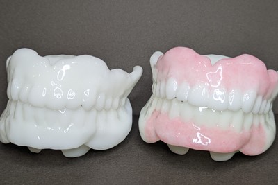 左：白一色　右：歯茎部分色付け