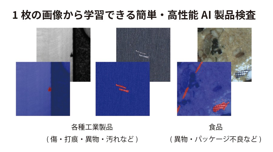 図4 gLupeによる検査例