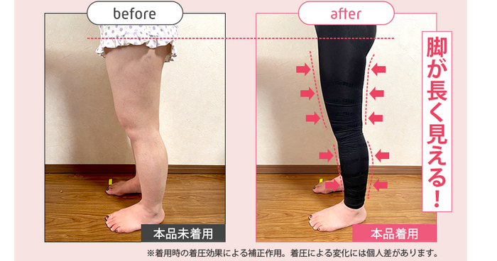 ストレグ脚のBefore／After