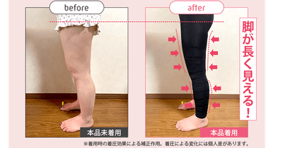 ストレグ脚のBefore/After