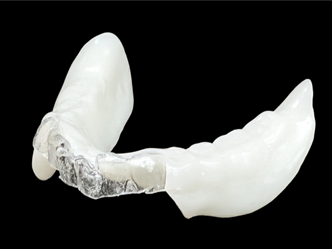 部分入れ歯も製作可能になった「おやすみ入れ歯」