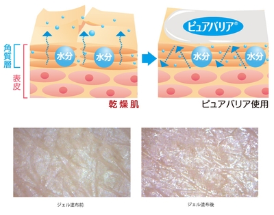 before　after