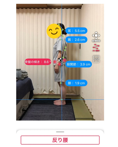 AI姿勢診断1