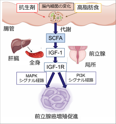 （図）前立腺がん増殖促進の仕組み