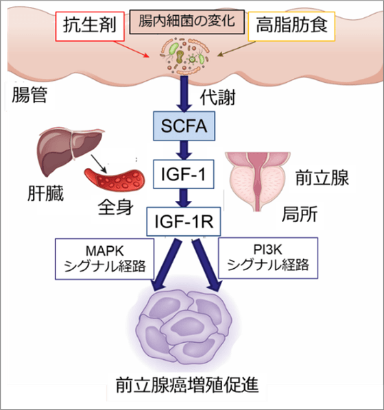 (図)前立腺がん増殖促進の仕組み