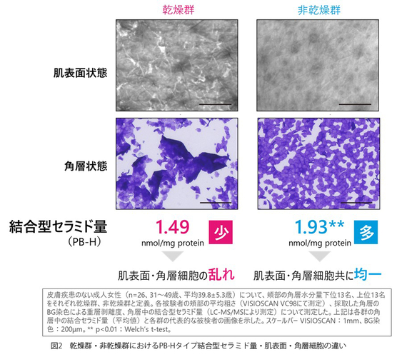 図2 乾燥群・非乾燥群におけるPB-Hタイプ結合型セラミド量・肌表面・角層細胞の違い