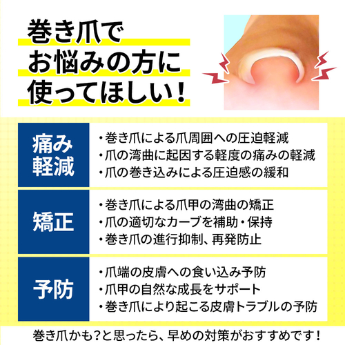 巻き爪クリップ 効能